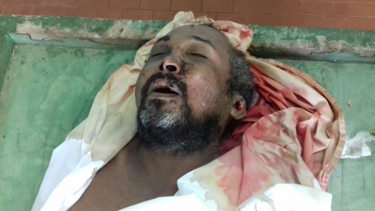 HOMEM MORTO NO HGM DE CODÓ SEM IDENTIFICAÇÃO -QUEM RECONHECER ESTE HOMEM PROCURE O HGM DE CODÓ.