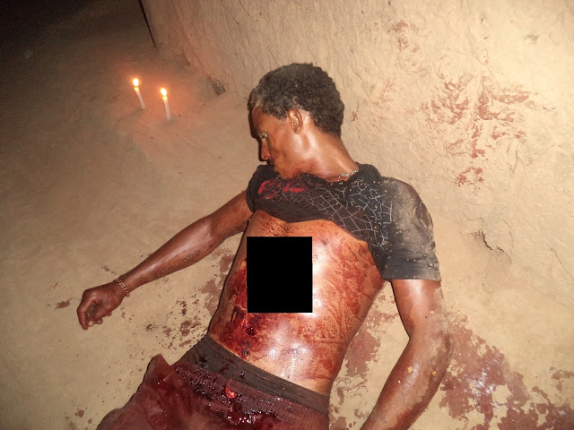 IRMÃO MATA PRÓPRIO IRMÃO COM UMA FOICE NA CIDADE DE TIMBIRAS.