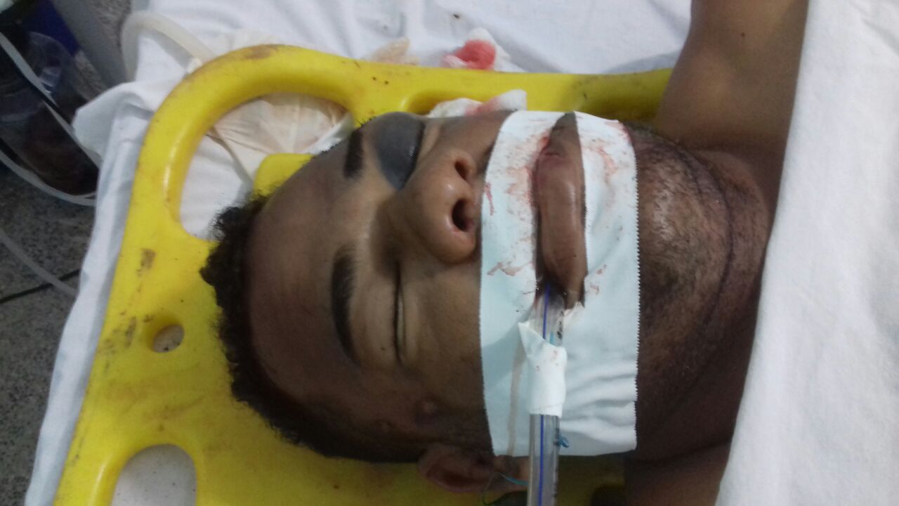 IDENTIFICADO JOVEM QUE FOI LEVADO PARA HOSPITAL DE CODÓ EM ESTADO GRAVE, VITIMA DE ACIDENTE.