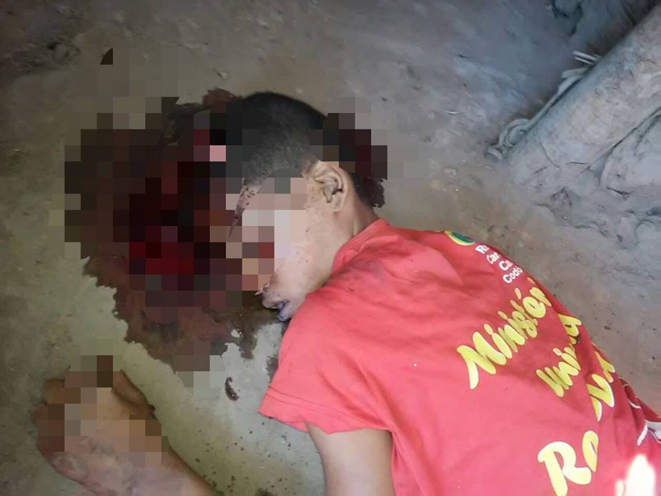 GAROTO DE 11 ANOS É MORTO COM UM TIRO NA CABEÇA ACIDENTALMENTE NA ZONA RURAL DE CODÓ.