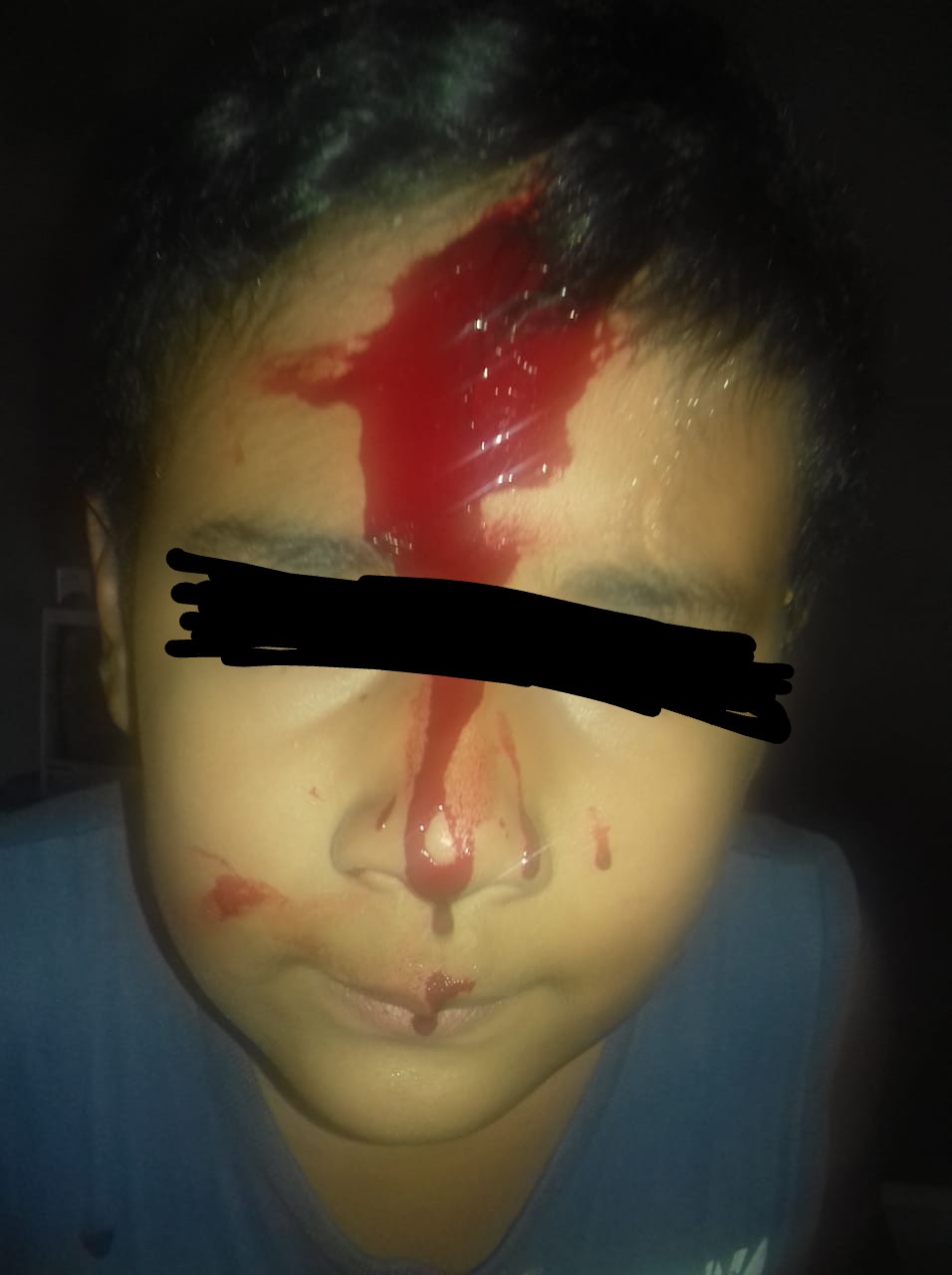 PAI DROGADO INVADE CASA DE EX-ESPOSA, QUEBRA CABEÇA DE CRIANÇA COM BARRA DE FERRO E MÃE DENUNCIA QUE CONSELHO TUTELAR DE CODÓ NUNCA FEZ NADA PRA AJUDAR A CRIANÇA