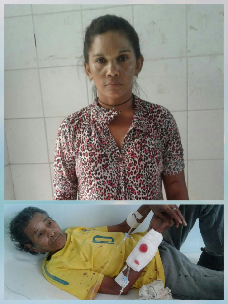MULHER AGRIDE IDOSO COM FERIMENTOS PROFUNDO NOS DOIS BRAÇOS COM ARMA BRANCA EM ZONA RURAL DE CODÓ