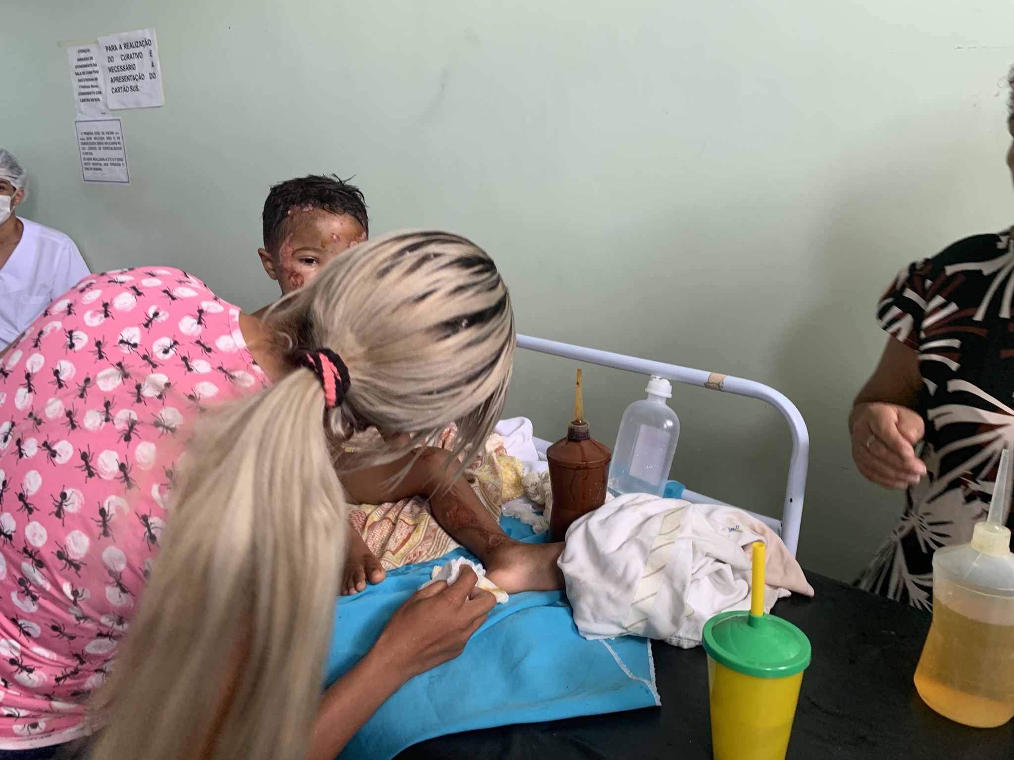 PREFEITO NAGIB CONSEGUE LEITO DE UTI EM SÃO LUÍS  PARA CRIANÇA DE 3 ANOS QUE GRITAVA DE DOR NO HGM DE CODÓ