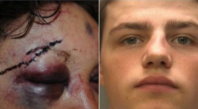 Vítima de estupro limpa sangue na roupa do agressor e prova crime