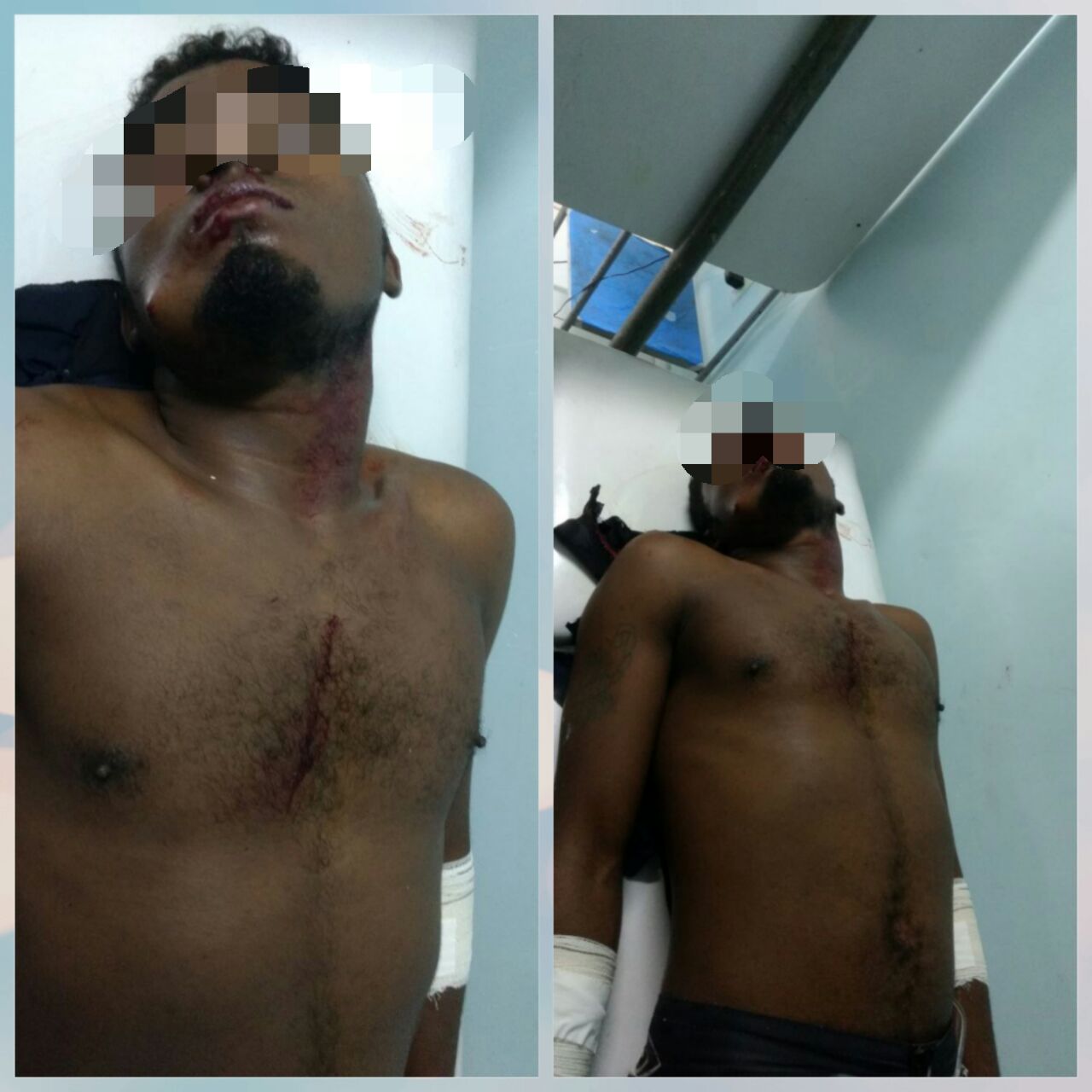TENTATIVA DE HOMICÍDIO EM CODÓ ONTEM CONTRA UM MENOR APELIDADO POR PCC