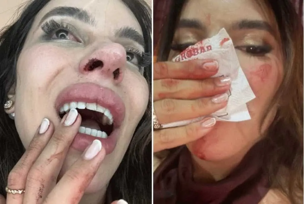Influenciadora Lea Reis relata agressão em bar de Balsas; polícia investiga se houve transfobia