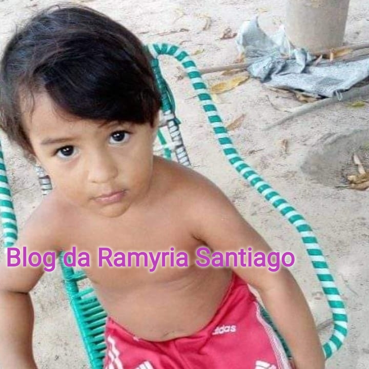UMA CRIANÇA DE 3 ANOS MORREU APÓS ACIDENTE COM COMBUSTÍVEL INFLAMÁVEL EM ZONA RURAL DE CODÓ.