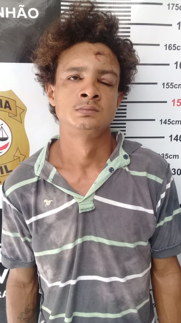MÃE NÃO AGUENTA MAIS APANHAR DO PRÓPRIO FILHO EM CODÓ: ELA AFIRMOU QUE HÁ ANOS VEM APANHANDO DO FILHO.