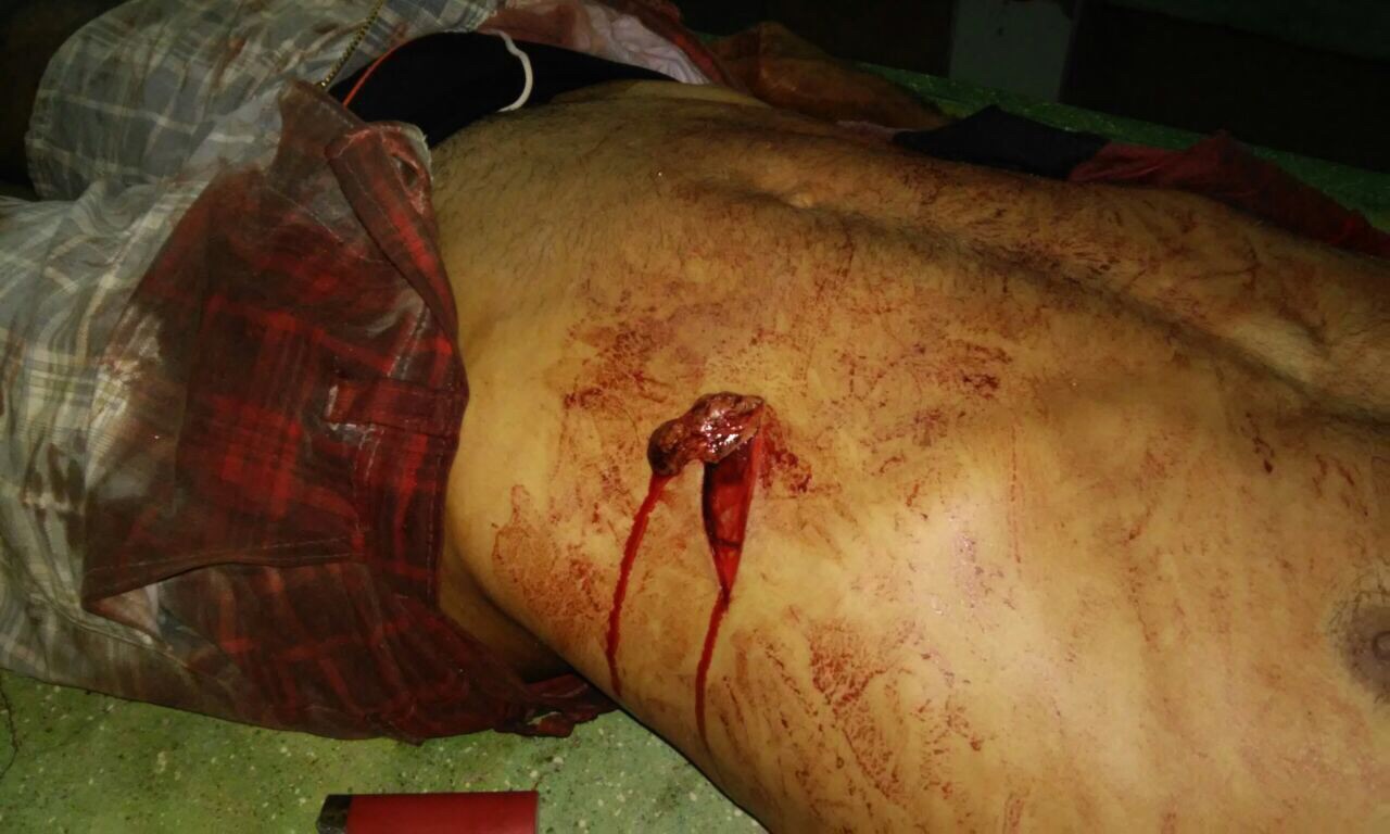 MAIS UM HOMICÍDIO EM CODÓ NA NOITE DE ONTEM,QUARTA-FEIRA 08.