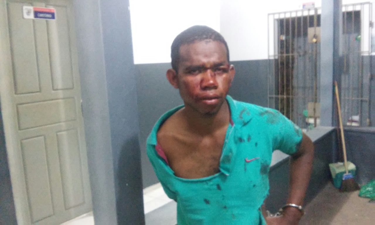 LADRÃO DE CELULAR FOI ROUBAR EM CODÓ E APANHA TANTO DE MORADORES QUE PEDE SOCORRO A POLICIA.
