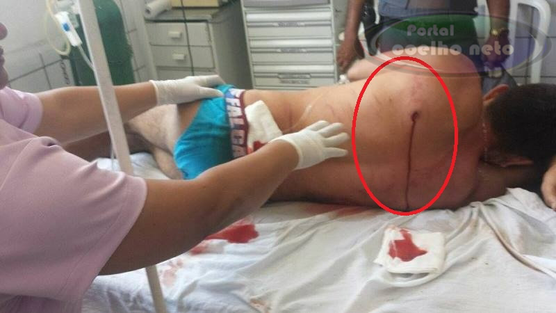Comerciante vítima de assalto vira acusado de homicídio depois de perseguir bandidos e matar um dos assaltantes e deixar o outro gravemente ferido