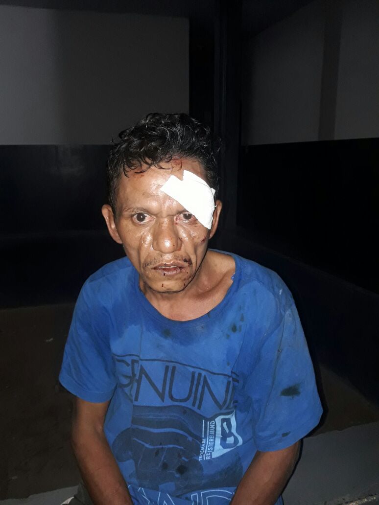 HOMEM ARROMBA LOJA EM CODÓ E ACABA PRESO E FERIDO APÓS INVADIR O LOCAL PELO TELHADO