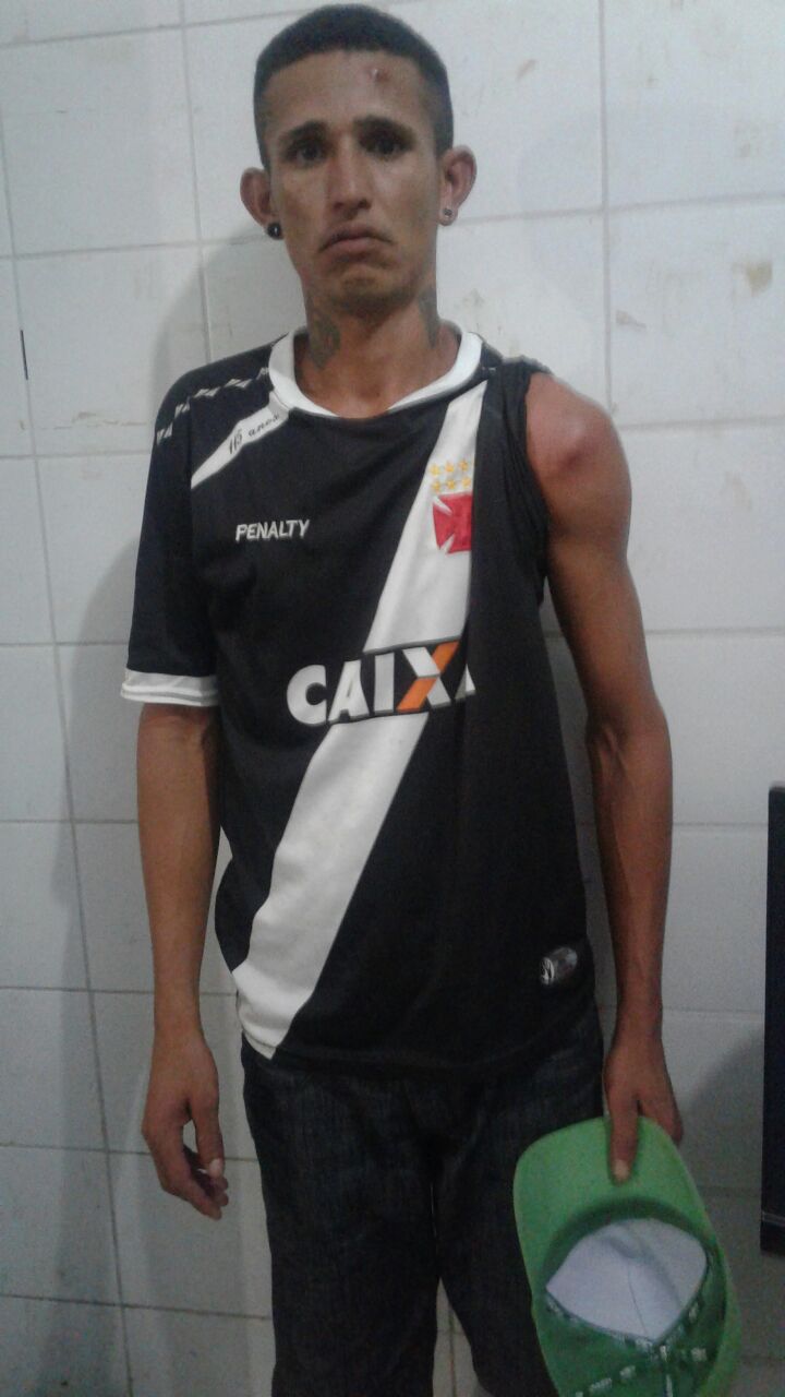 HOMEM É PRESO POR AGREDIR A NAMORADA NO ROSTO E NAS COSTAS CODÓ