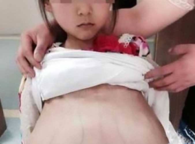 Uma garota de 12 anos, que estava grávida, foi levada ao hospital, por um homem de 40 anos de idade, que dizia ser seu marido