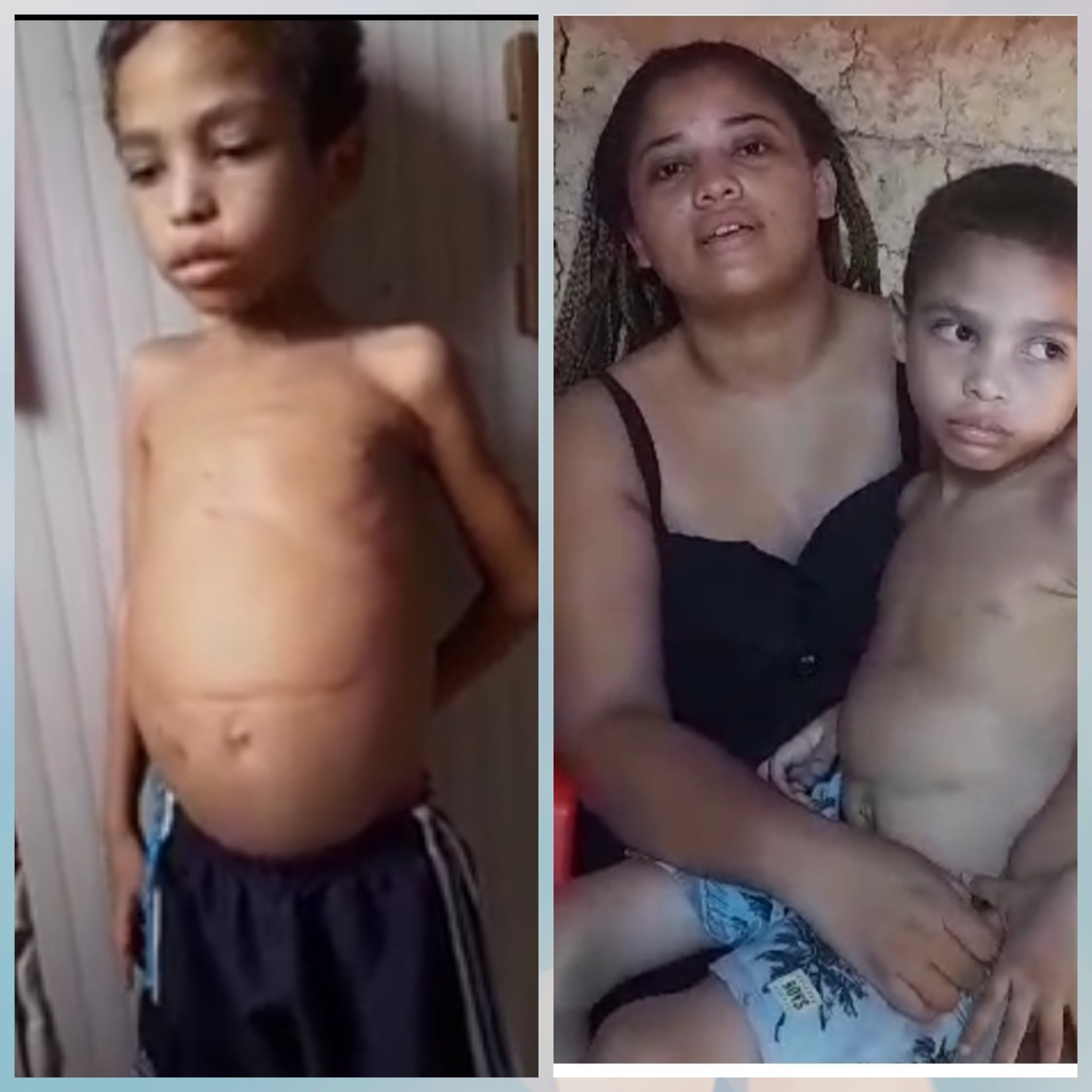 Um pedido de socorro! Mãe que foi expulsa do povoado Mamorana em Timbiras está com o filho em estado grave e mesmo assim o líder do povoado não permite a volta dela. Ela pede ajuda pra salvar a criança e voltar pra sua casa no povoado.