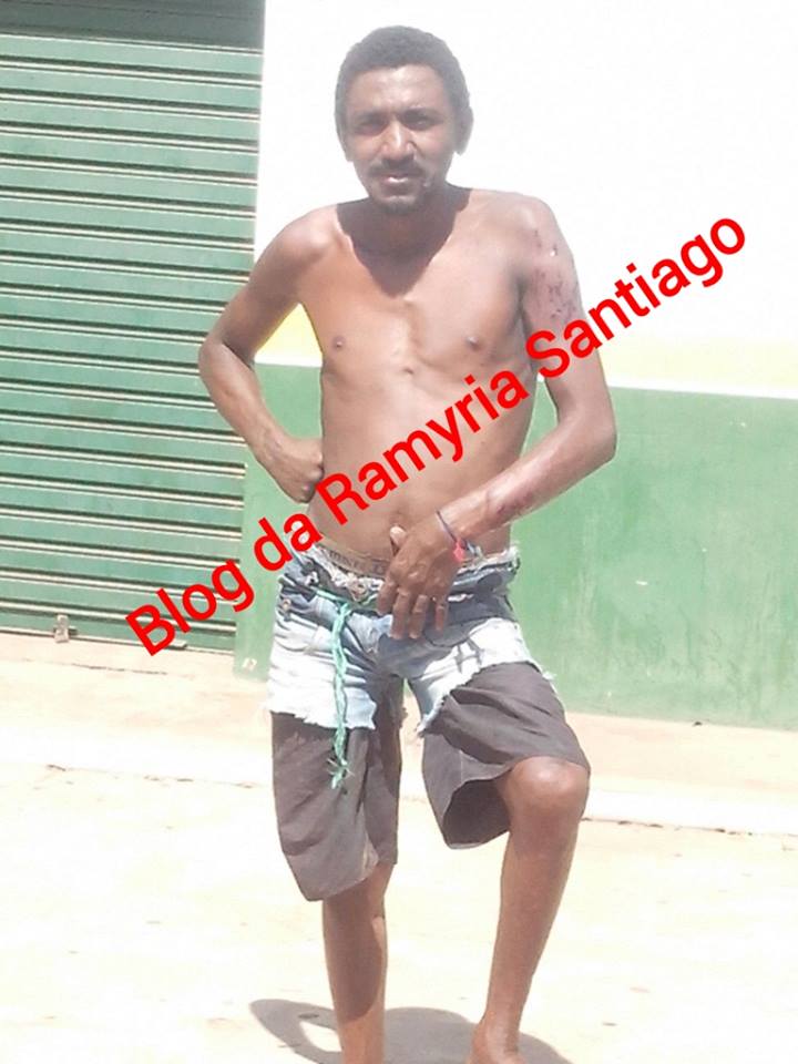 RAPAZ TENTA MATAR DOENTE MENTAL EM CODÓ COM UM TIRO DE GARRUCHA