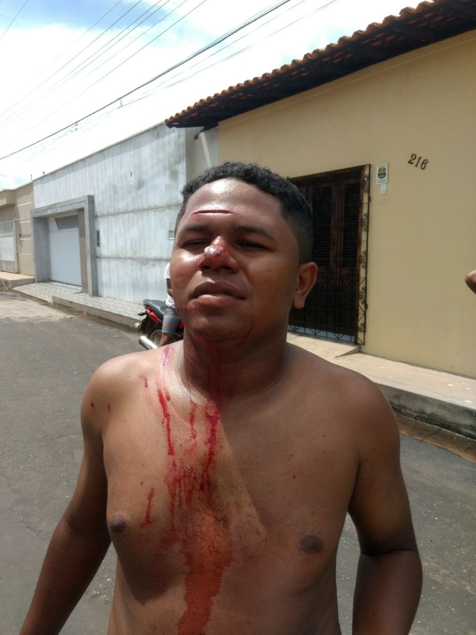 ACUSADO DE ENVOLVIMENTO EM LESÃO CORPORAL POR ARMA BRANCA É PRESO EM CODÓ