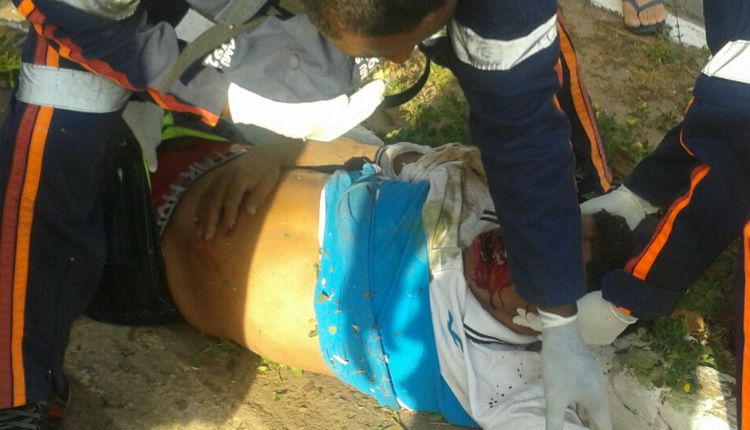 Mulher morre após ter perna decepada em acidente de moto no fim de semana