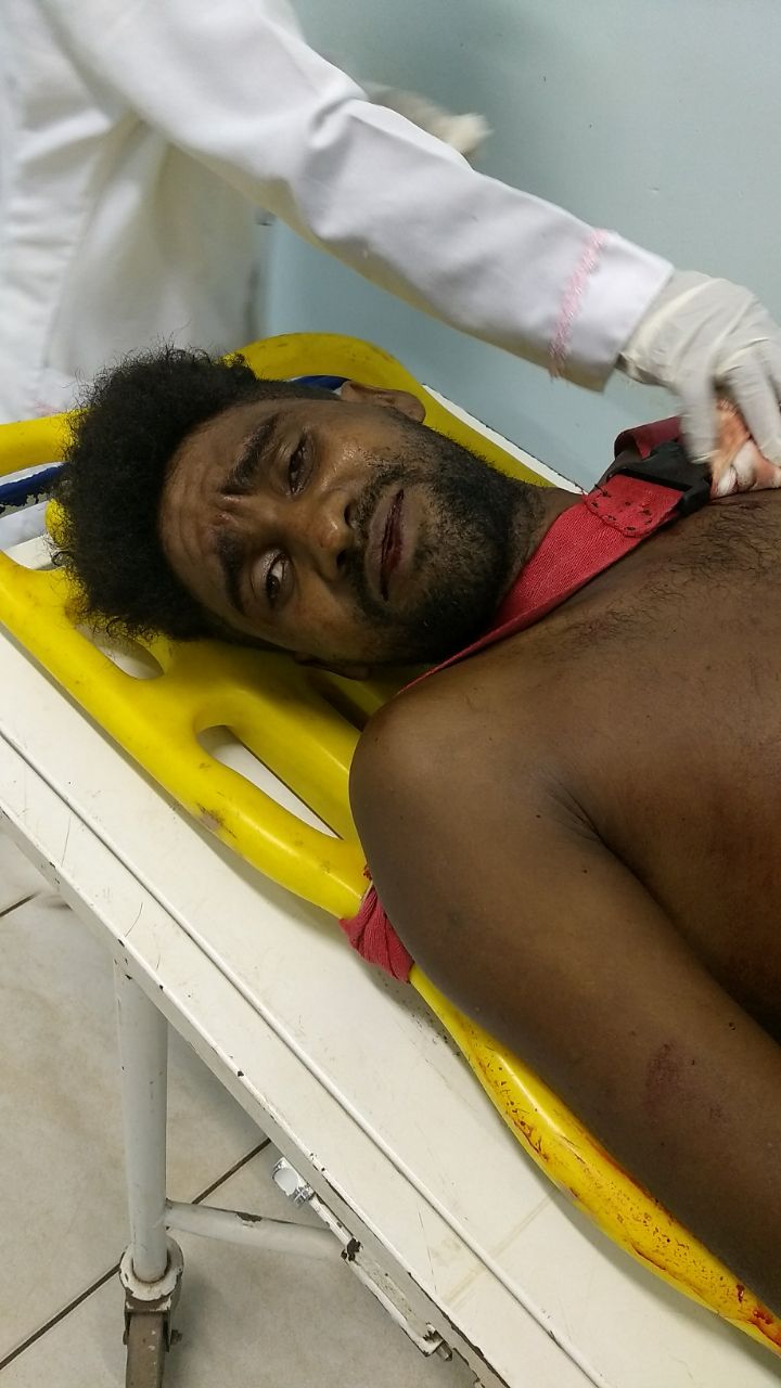 TENTATIVA DE HOMICÍDIO EM CODÓ NA MADRUGADA DE HOJE DIA 05.