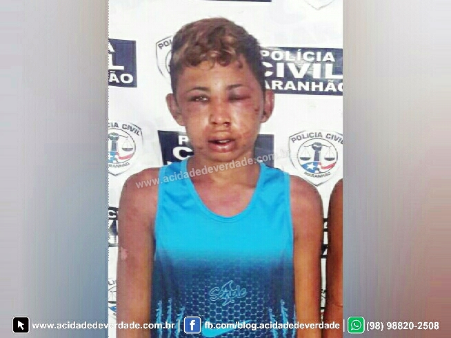 HOMEM É PRESO EM CENTRO NOVO DO MARANHÃO ACUSADO DE ESTUPRAR UMA CRIANÇA DE 02 ANOS DE IDADE.