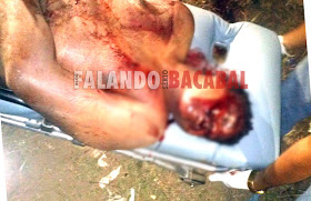 HOMEM É MORTO COM REQUINTES DE CRUELDADE  EM BACABAL-MA