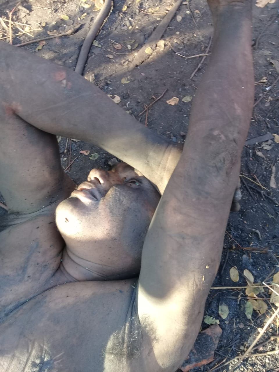 CORPO É ENCONTRADO HOJE EM CODÓ COM SINAL DE ARMA DE FOGO.