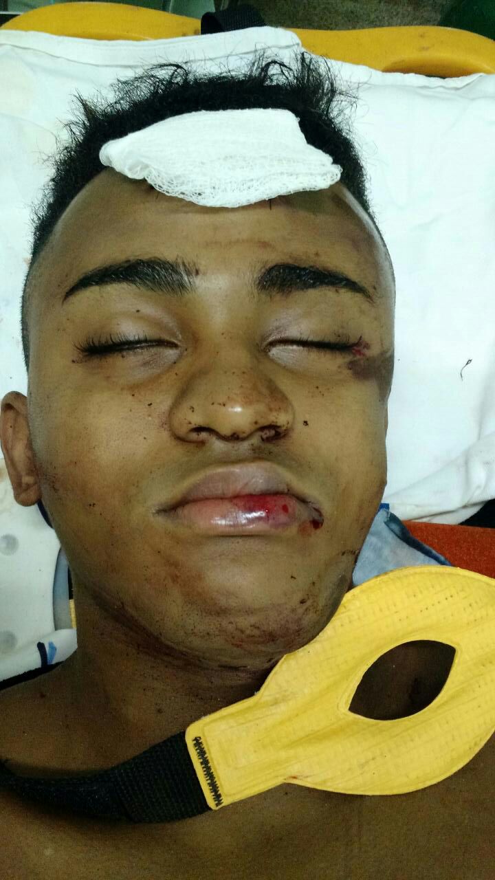 ATENÇÃO! JOVEM SOFRE ACIDENTE EM CODÓ E ESTÁ SEM IDENTIFICAÇÃO, QUEM CONHECER ENTRE EM CONTATO.