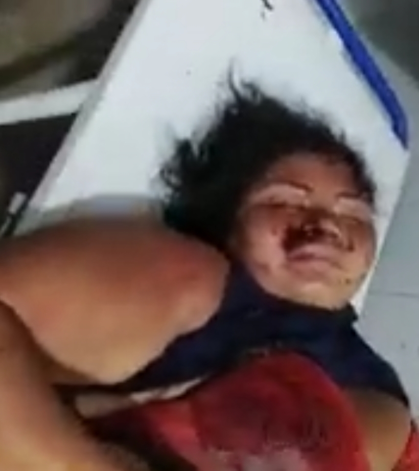 URGÊNTE. UMA MULHER VITIMA DE ACIDENTE SE ENCONTRA NO HOSPITAL HGM SEM IDENTIFICAÇÃO DE FAMILIARES. QUEM RECONHECER AVISAR A FAMÍLIA.