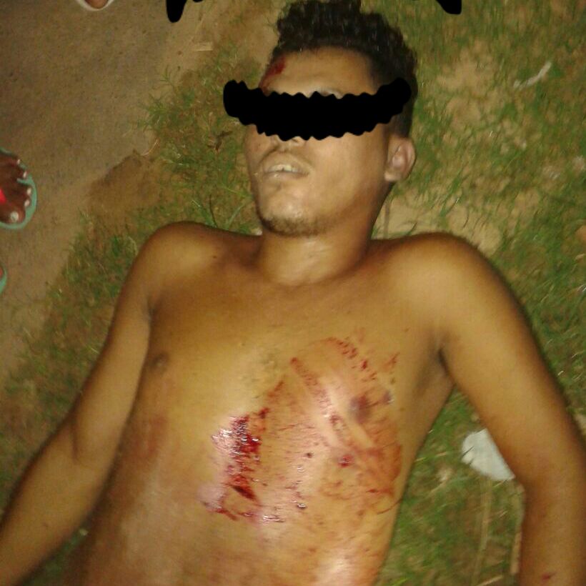 JOVEM É ASSASSINADO EM CODÓ NA NOITE DESTA QUARTA-FEIRA DIA 06