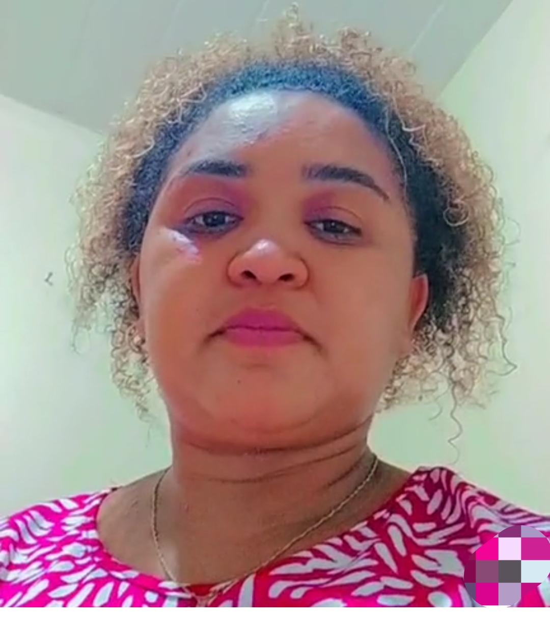 JOVEM DE NOME ALDINEIA QUE PRECISA ARRECADAR MAIS DE 100 MIL PRA CIRURGIA DISSE NA CÂMARA MUNICIPAL QUE FOI IMPEDIDA DE VENDER NO EVENTO DA FLIC PELO GOVERNO ZÉ FRANCISCO 