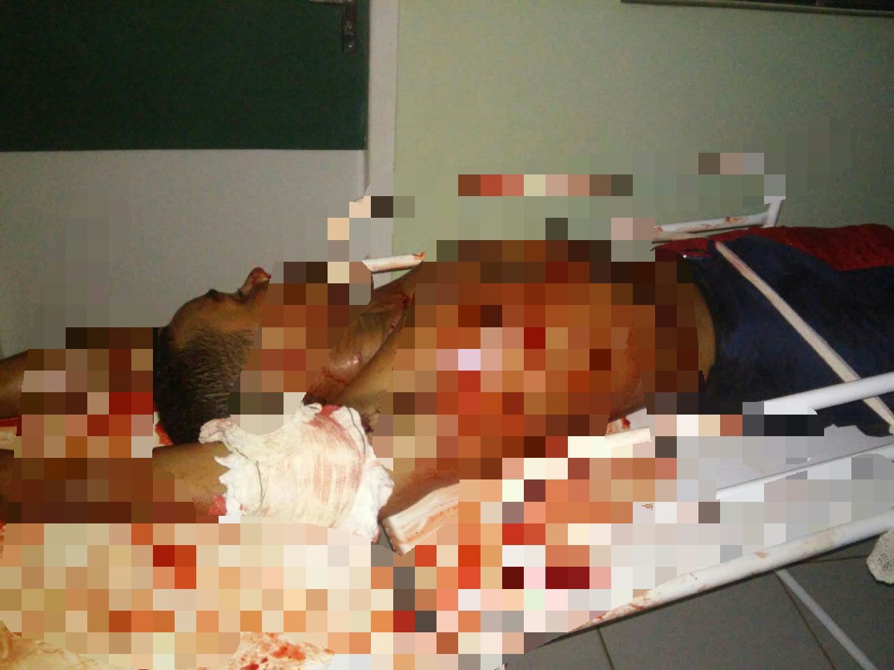 JOVEM É ASSASSINADO EM CODÓ COM 13 TIROS E UM OUTRO JOVEM LEVA 2 TIROS E SEU ESTADO É GRAVE.