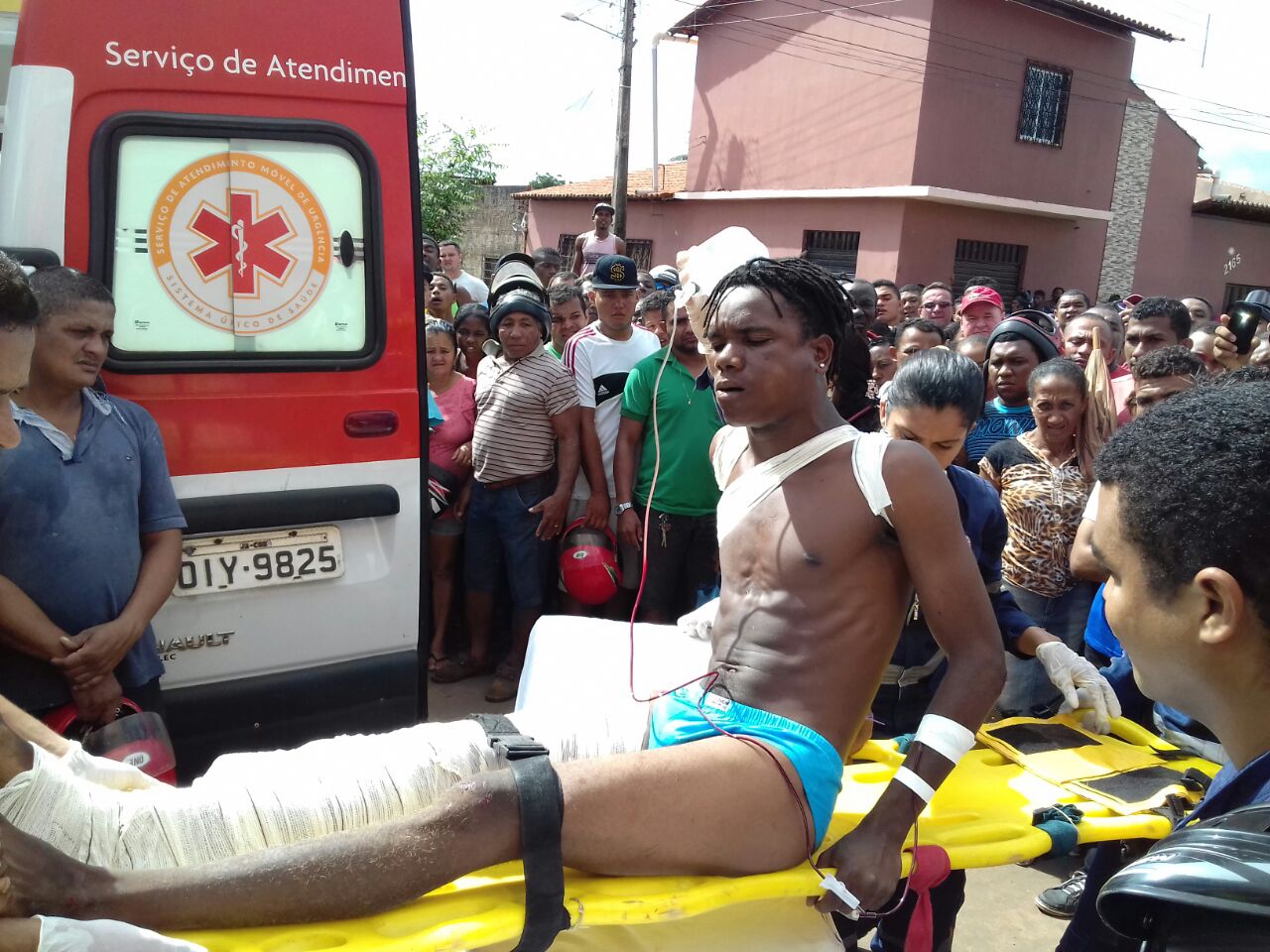 TENTATIVA DE HOMICÍDIO EM CODÓ CONTRA O RAPAZ CONHECIDO POR “CHOCOLATE” O MESMO LEVOU DOIS TIROS