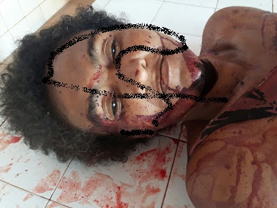 MULHER É ASSASSINADA A GOLPES DE FOICE E AUTOR DO CRIME É MORTO POR PARENTE DA VÍTIMA EM GONÇALVES DIAS