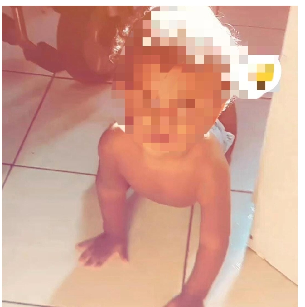 Bebê de 10 meses morre após ser atacado por cão da raça pitbull em Codó