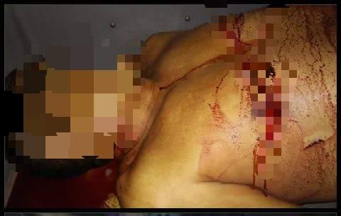 HOMICÍDIO NA ZONA RURAL DE CODÓ NA NOITE DE ONTEM.