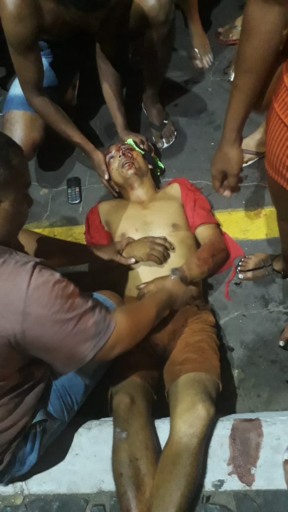 EM CODÓ HOMEM É ESPANCADO POR PELO MENOS 10 PESSOAS APÓS AMEAÇAR CLIENTES EM BAR COM FACÃO.