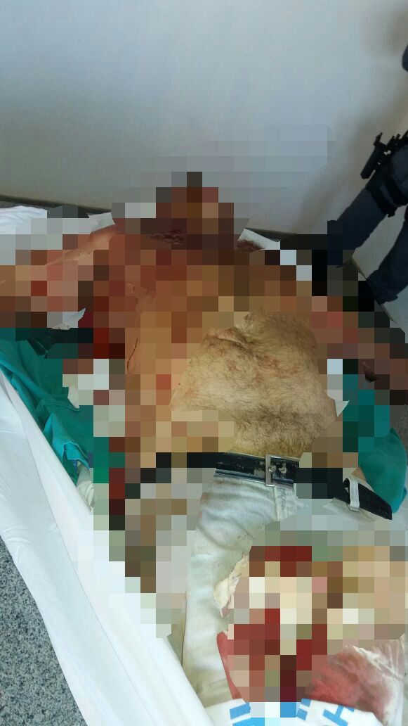 IRMÃO DO EX-PREFEITO DE TIMBIRAS CHICO DO FOTO É ASSASSINADO A FACADAS