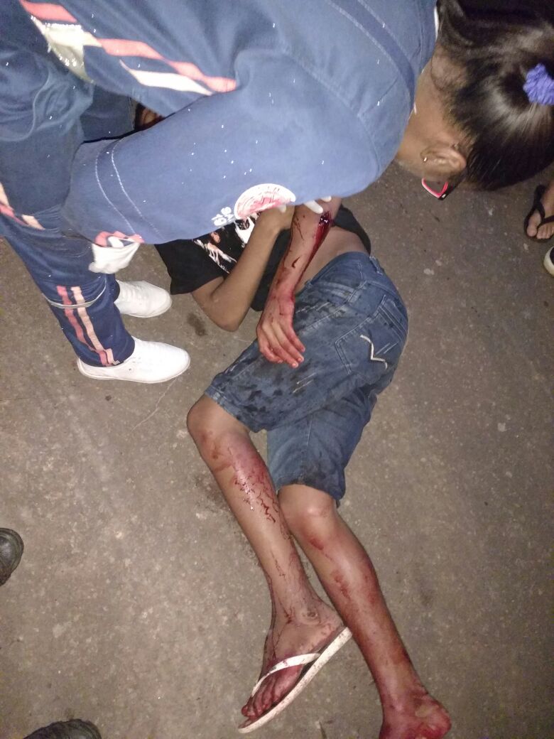 TENTATIVA DE HOMICÍDIO É REGISTRADA EM CODÓ NO CONJUNTO DALLAS