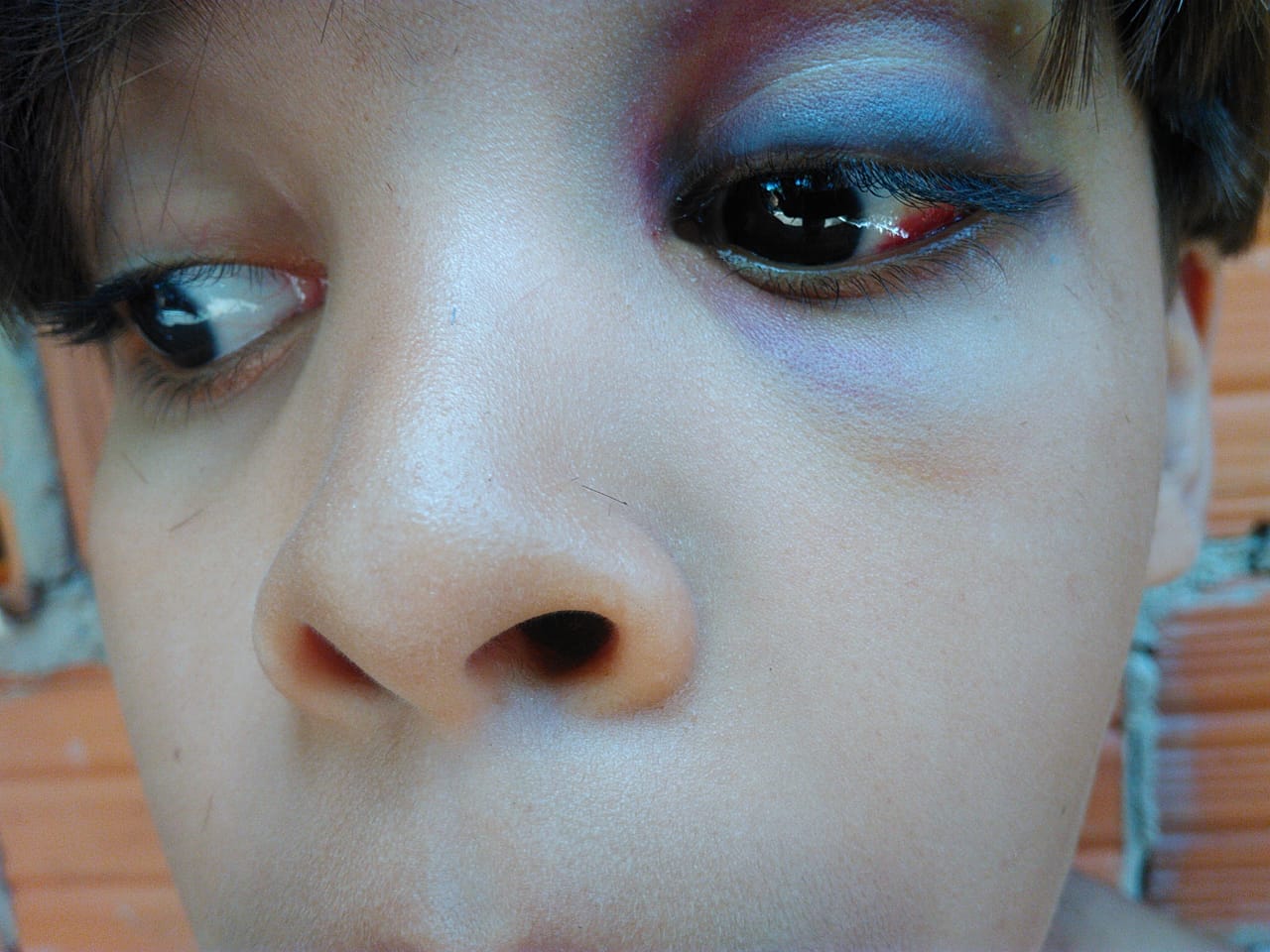 PAI QUER SABER O QUE ACONTECEU COM CRIANÇA DE 9 ANOS EM ESCOLA DE CODÓ. A CRIANÇA PARECE TER SIDO ESPANCADA, A DIREÇÃO NADA QUER DIZER!