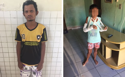 FILHO É PRESO APÓS AGREDIR E QUEBRAR OS BRAÇOS DA MÃE EM CHAPADINHA.