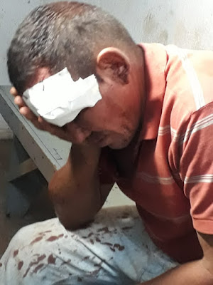 HOMEM ARROMBA IGREJA E É LINCHADO PARA TIRAR O DEMÔNIO DO CORPO NO MARANHÃO