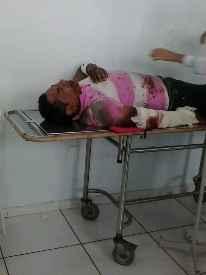 REPÓRTER DA FCTV FRANCISCO OLIVEIRA SOFRE ACIDENTE NA TARDE DE HOJE QUINTA FEIRA (19)