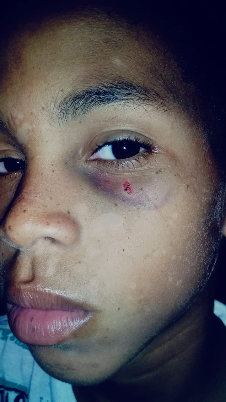 MÃE DENUNCIA QUE CRIANÇA É AGREDIDA EM ESCOLA, E DIZ QUE DIRETORA E PROFESSOR SÃO CONIVENTES COM OS ATOS NA ESCOLA PICA PAU