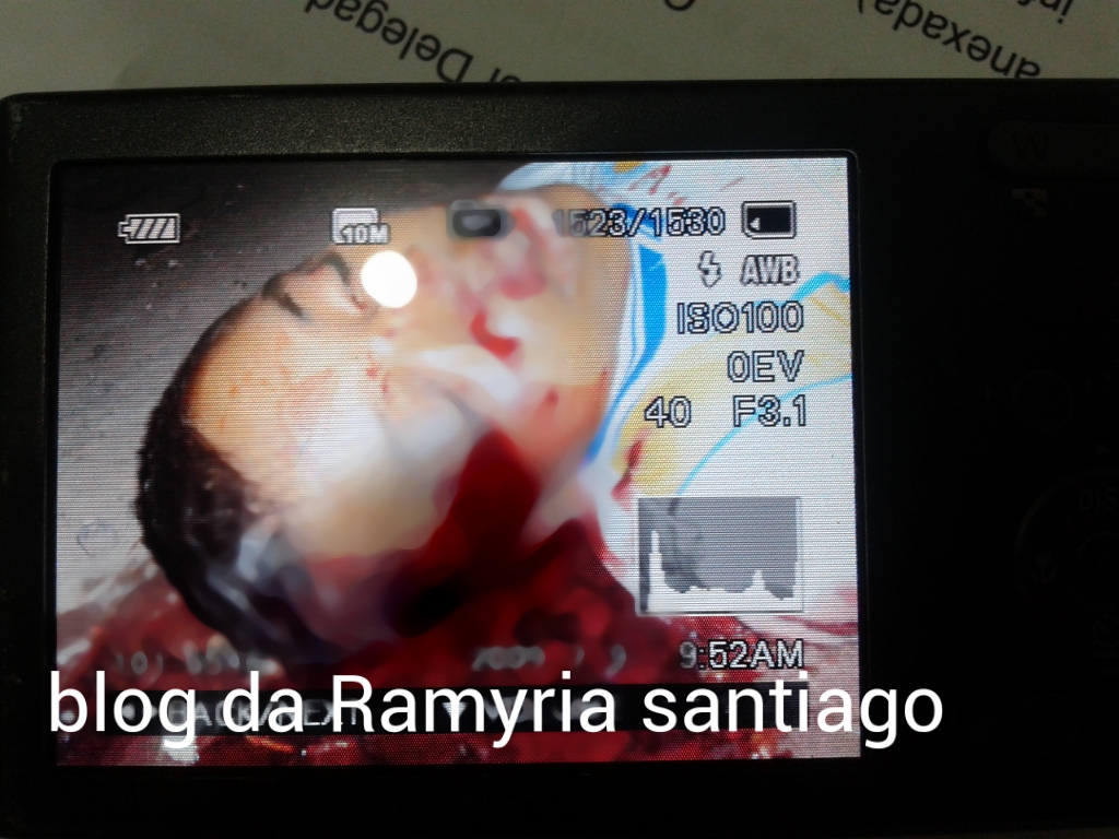 MENOR MATA OUTRO MENOR COM UM TIRO NA CABEÇA EM CODÓ,NA NOITE DE ONTEM DOMINGO 28 DE JUNHO.