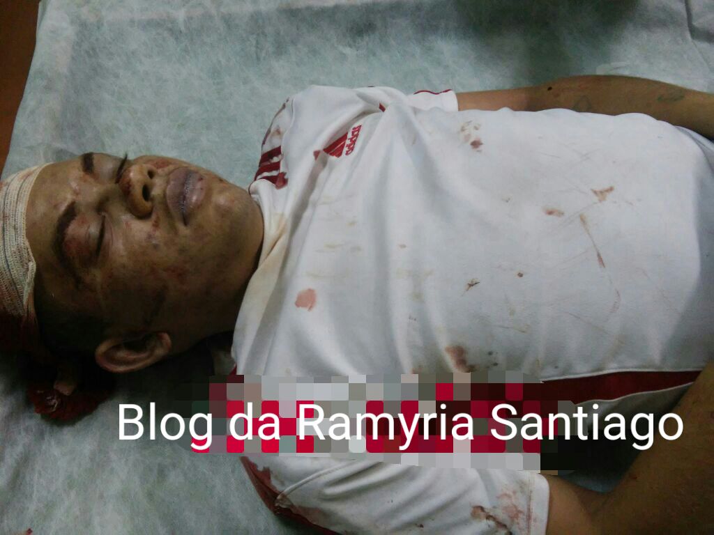 MAIS UM ASSASSINATO É REGISTRADO NA MANHA DE HOJE  EM CODÓ – 07 DE NOVEMBRO