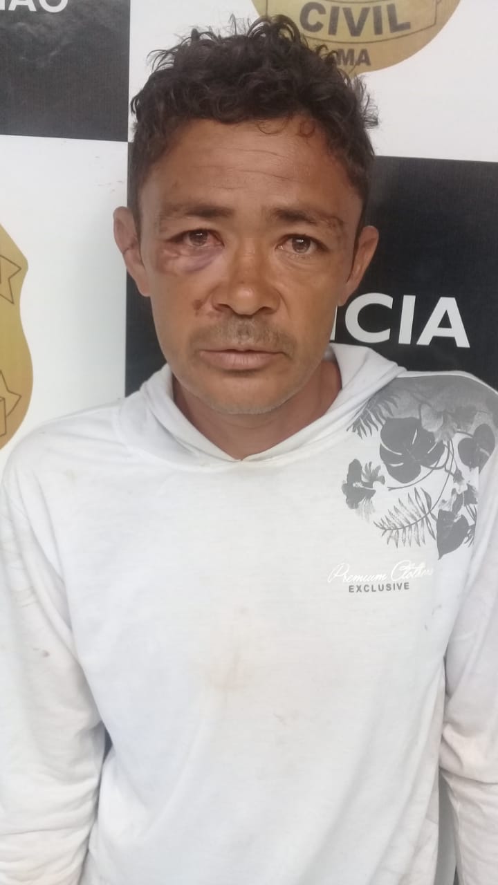 HOMEM É PRESO EM CODÓ APÓS AGREDIR A PRÓPRIA MÃE E DEIXÁ-LA TRANCADA DENTRO DE CASA