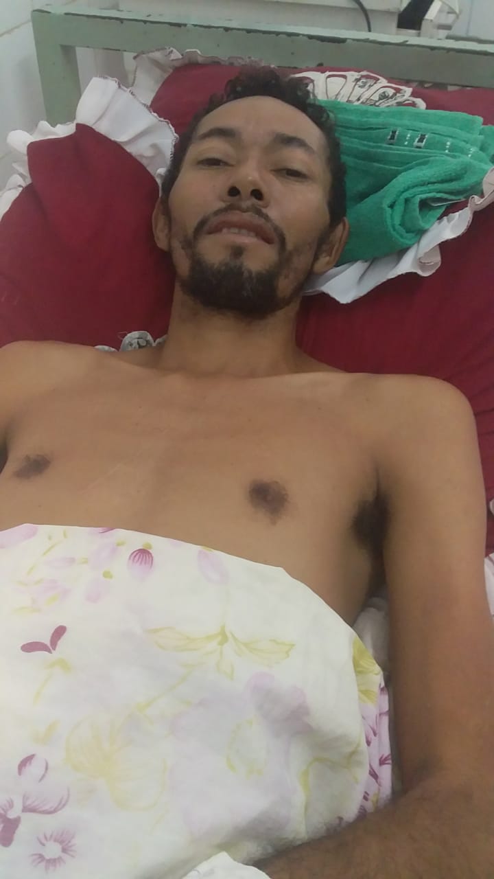 FAMÍLIA DE HOMEM QUE LEVOU TIRO DE PM EM CODÓ PEDE AJUDA POIS ESTÃO PASSADO NECESSIDADES E A VÍTIMA CONTINUA NO HOSPITAL EM ESTADO GRAVE SEM PODER SUSTENTAR SUA FAMÍLIA.