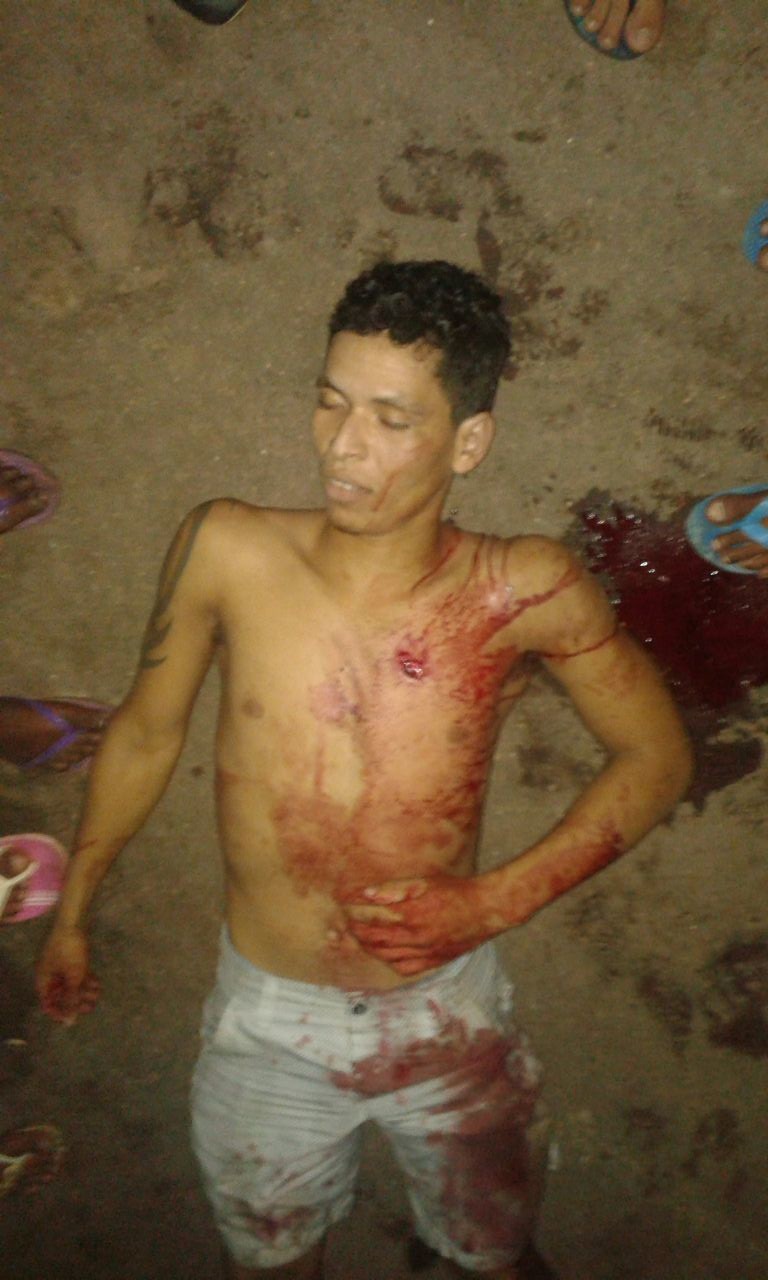 DOIS HOMENS FORAM ESFAQUEADOS ONTEM A NOITE EM CODÓ,UM DELES JÁ MORREU.