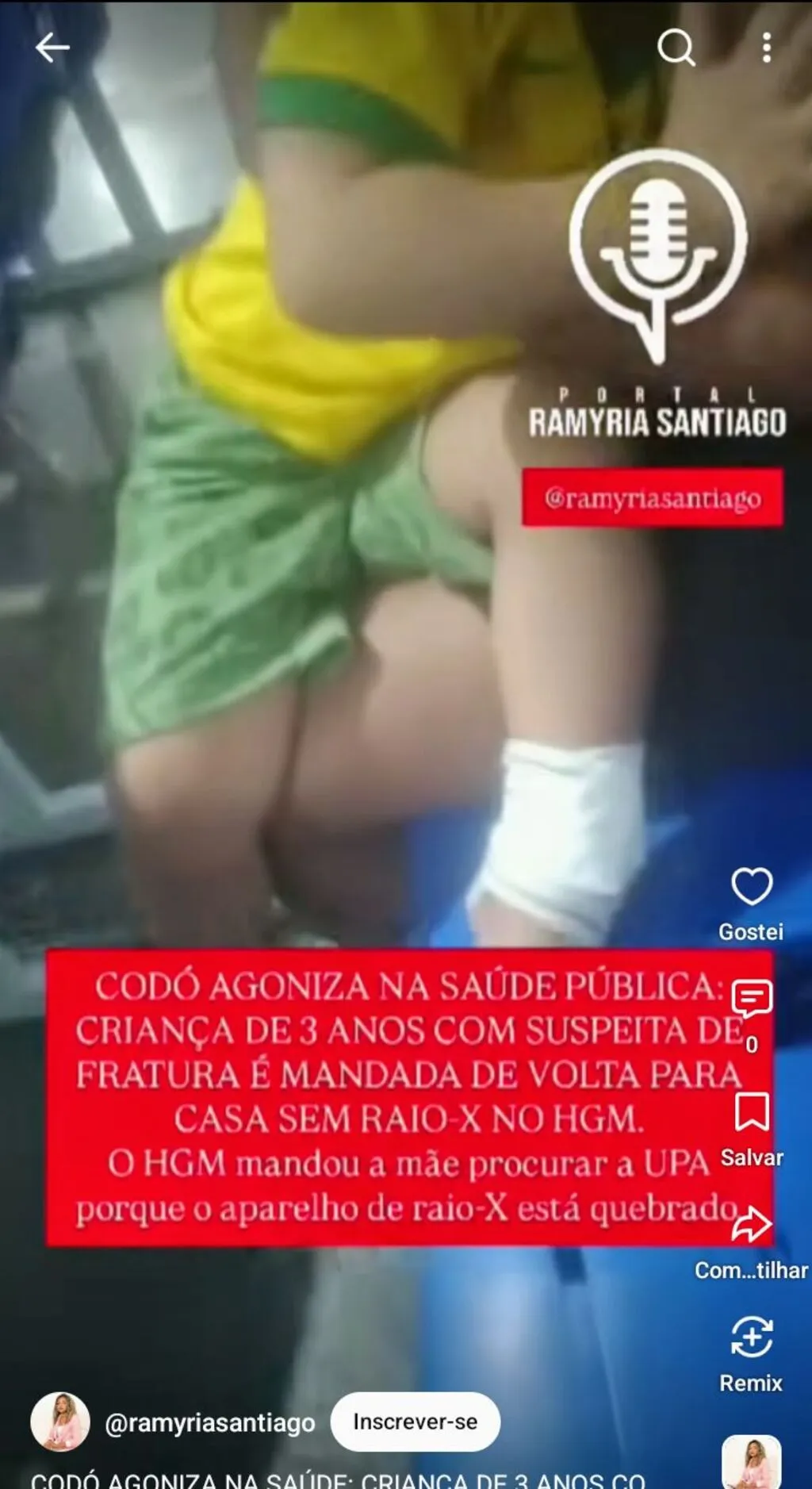 CODÓ AGONIZA NA SAÚDE PÚBLICA: CRIANÇA DE 3 ANOS COM SUSPEITA DE FRATURA É MANDADA DE VOLTA PARA CASA SEM RAIO-X NO HGM E NA UPA