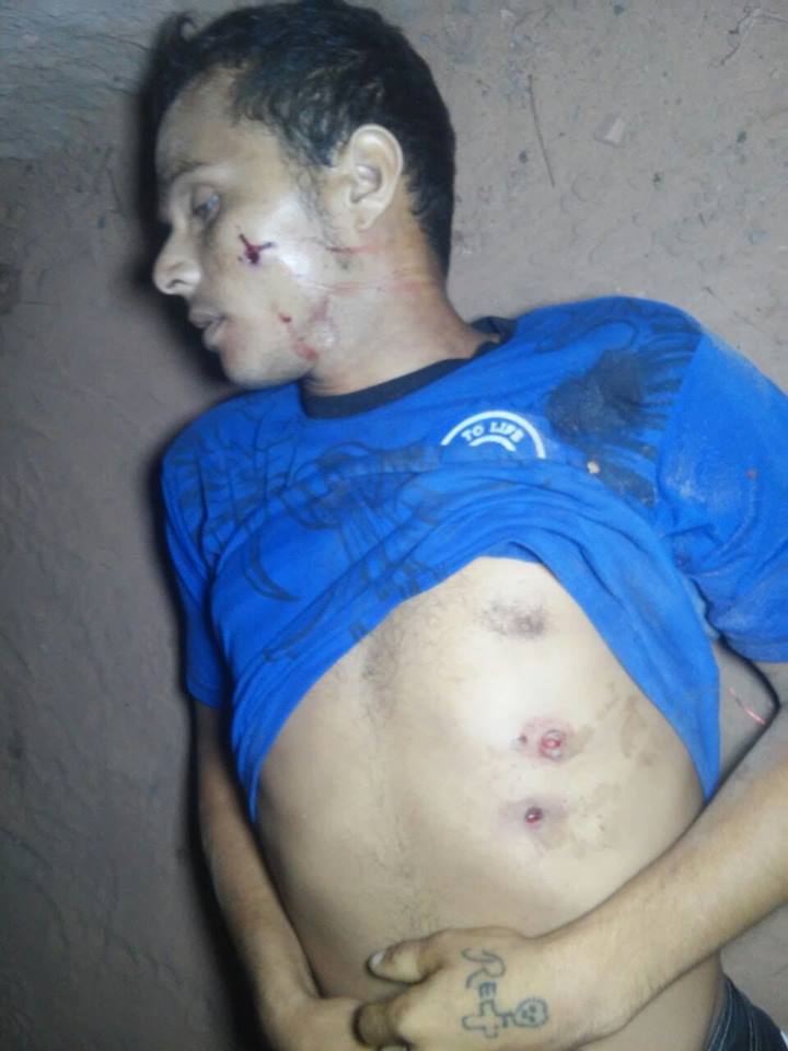 HOMICÍDIO EM CODÓ JOVEM LEVA TRÊS TIROS E MORRE NO LOCAL NA NOITE DESTE DOMINGO